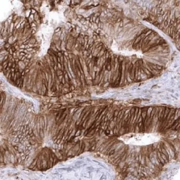 PD-L1 antibody [MSVA-711R] HistoMAX (GTX04362)