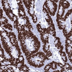 SATB2 antibody [MSVA-702R] HistoMAX (GTX04414) 