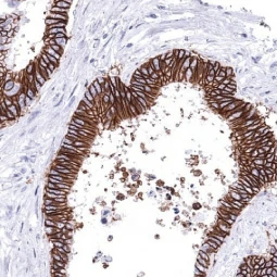 Thrombomodulin antibody [MSVA-141M] HistoMAX (GTX04446)