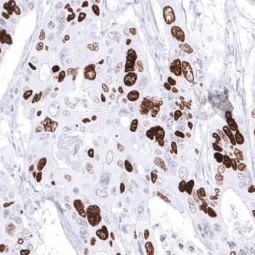 Topoisomerase II alpha antibody [MSVA-802R] HistoMAX (GTX04422) 