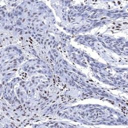 Ku80 antibody [MSVA-880M] HistoMAX (GTX04480)