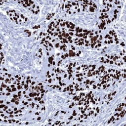 p63 antibody [MSVA-063R] HistoMAX (GTX04458)