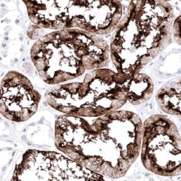 ACE2 antibody [MSVA-919R] HistoMAX (GTX04425)