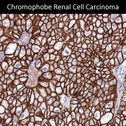 CDH16 antibody [MSVA-516R] HistoMAX (GTX04455)