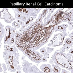 Collagen IV antibody [MSVA-704R] HistoMAX (GTX04434)