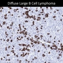 CD3 epsilon antibody [MSVA-003R] HistoMAX (GTX04389)