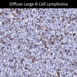 CTLA4 antibody [MSVA-152R] HistoMAX (GTX04439)