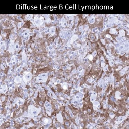 Factor XIIIa antibody [MSVA-813R] HistoMAX (GTX04452)