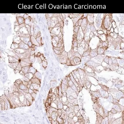 Occludin antibody [MSVA-415M] HistoMAX (GTX04461)