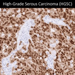 PAX8 antibody [MSVA-708R] HistoMAX (GTX04430)