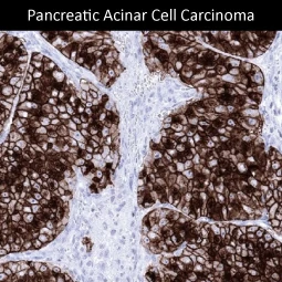 GP2 antibody [MSVA-475M] HistoMAX (GTX04436)