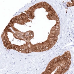 TFF1 antibody [MSVA-482M] HistoMAX (GTX04488)