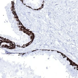 Cytokeratin 5 antibody [MSVA-605M] HistoMAX (GTX04402)