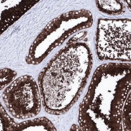 Prostatic Acid Phosphatase antibody [MSVA-452M] HistoMAX (GTX04396)