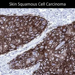 GluT1 antibody [MSVA-401R] HistoMAX (GTX04469)