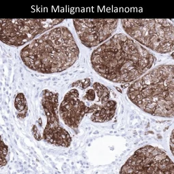 Melan A antibody [MSVA-901M+] HistoMAX (GTX04384)