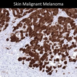 S100 antibody [MSVA-490R] HistoMAX (GTX04404)