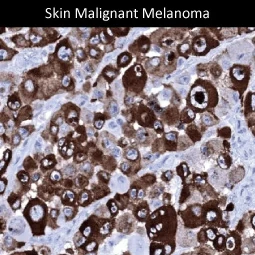 Melanoma gp100 antibody [MSVA-617R] (GTX04382)