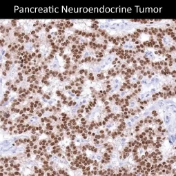 PAX6 antibody [MSVA-706M] HistoMAX (GTX04487)