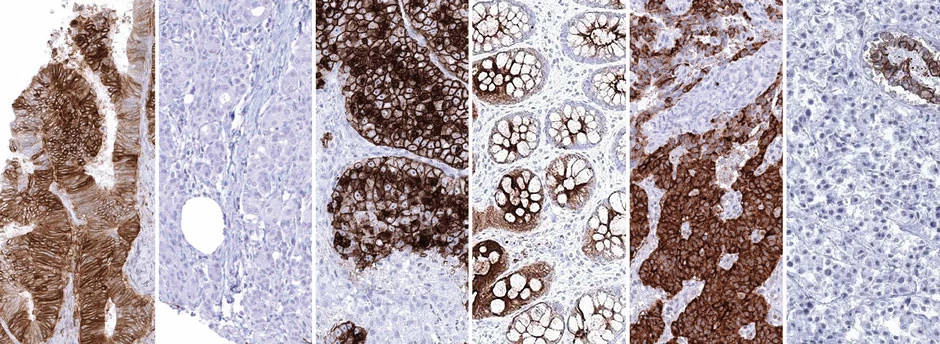 HistoMAX – IHC-validated Antibodies