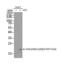 Hepatitis C Virus Core Antigen antibody