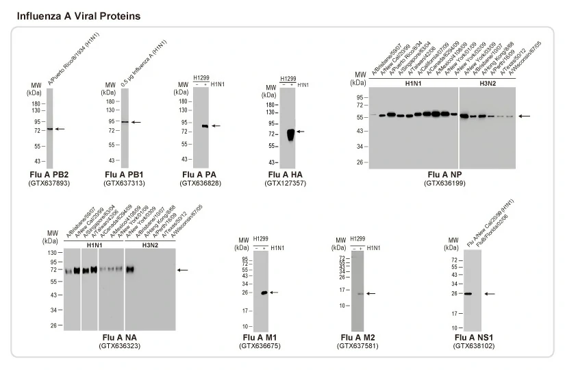 p53 antibody [HL2242] (GTX638291)
