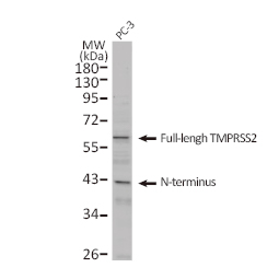 TMPRSS2 antibody [N2C3] (GTX100743)