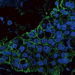 AXL antibody (GTX129407)