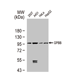 GPBB antibody(GTX104291)