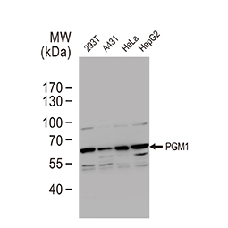 PGM1 antibody(GTX110069)