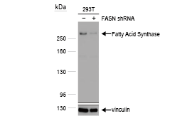 Fatty Acid Synthase antibody [GT556] 