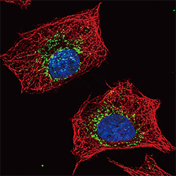 ACADM antibody