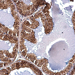 ACAA2 antibody