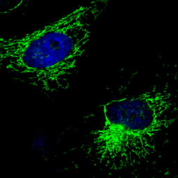 UQCRC1 antibody [GT139] (GTX630413)