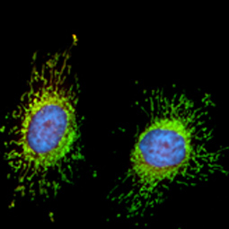 FIS1 antibody [GT9810] (GTX631209)