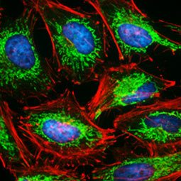 SDHA antibody [GT20710] (GTX632636)