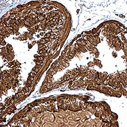 PGLS antibody