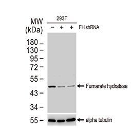 Fumarate hydratase antibody