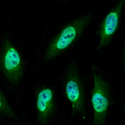 Nucleoporin-p62-antibody