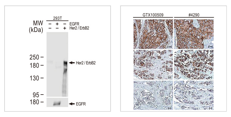 Her2 / ErbB2 antibody