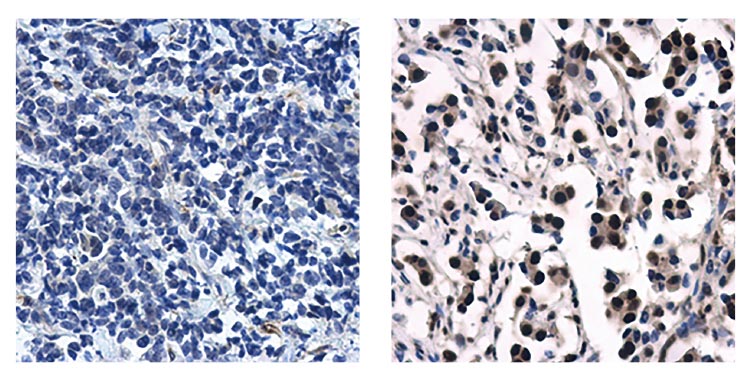 Progesterone Receptor antibody [N1], N-term