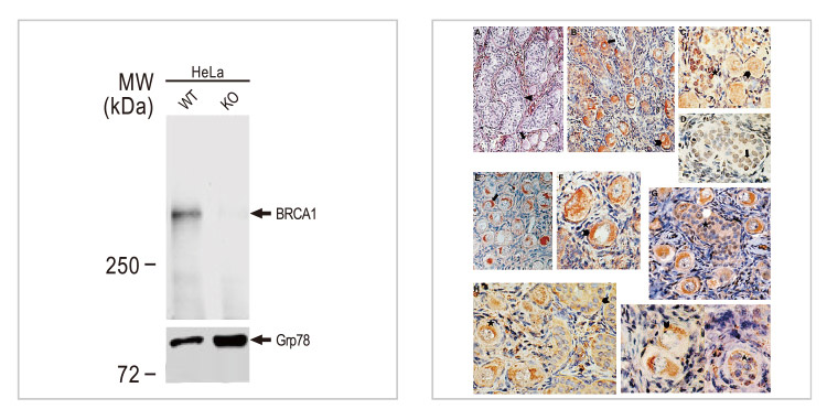 BRCA1 antibody [17F8] - ChIP grade