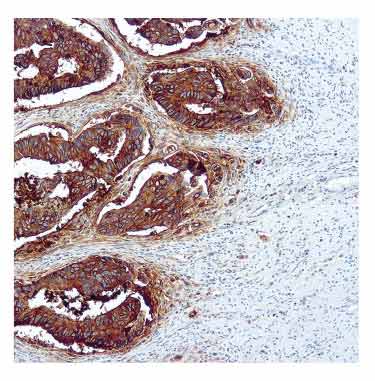 CEA antibody [Col-1]