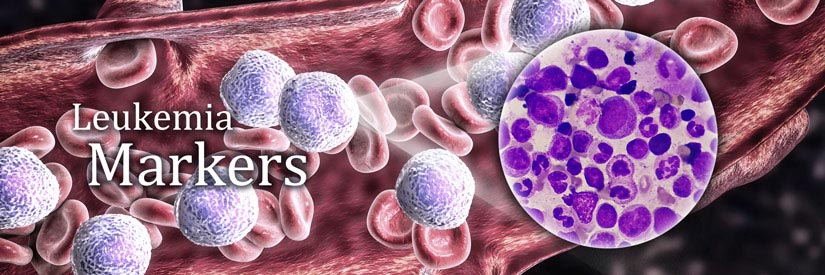 Leukemia Markers