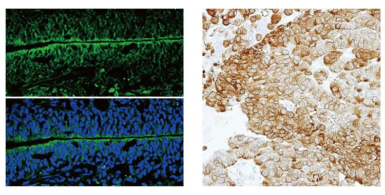 NSE antibody [N1C1]