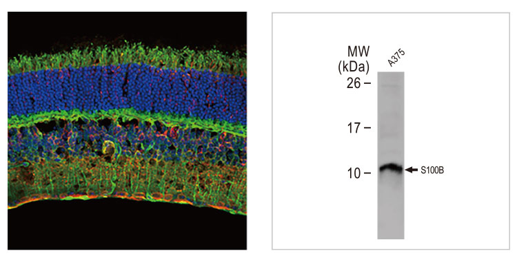 S100 beta antibody