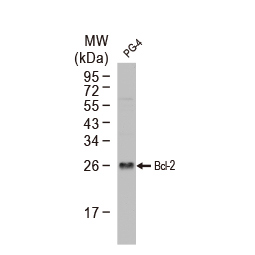 Bcl-2 antibody [N1N2], N-term