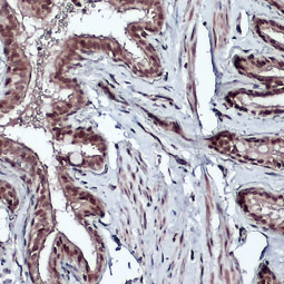 Bmi1 antibody