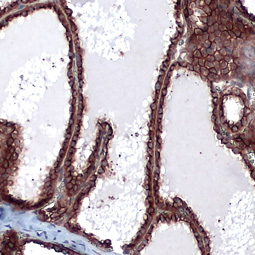 Cytokeratin 19 antibody [N1C1]