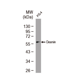 Desmin antibody